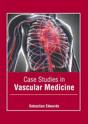 Sebastian Edwards - Case Studies in Vascular Medicine, Inbunden