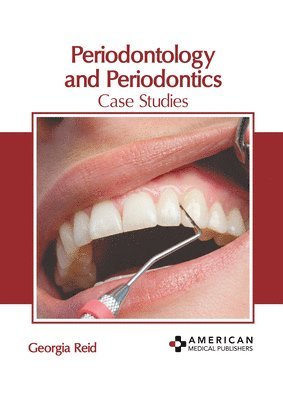 bokomslag Periodontology and Periodontics: Case Studies
