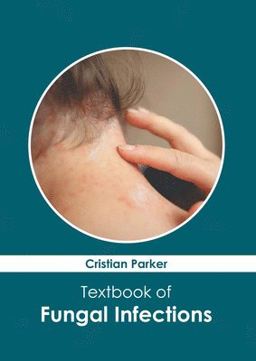 bokomslag Textbook of Fungal Infections