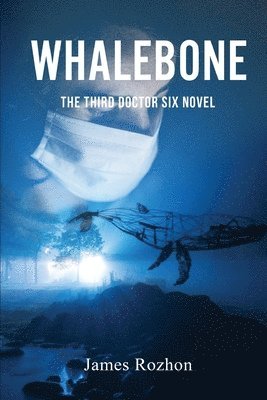 Whalebone 1