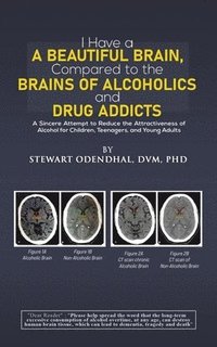 bokomslag I Have a Beautiful Brain, Compared to the Brains of Alcoholics and Drug Addicts