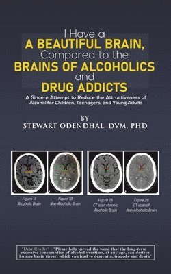 Stewart Odendhal, DVM, PhD, DVM Odendhal, DVM Stewart Odendhal - I Have a Beautiful Brain, Compared to the Brains of Alcoholics and Drug Addicts, Häftad