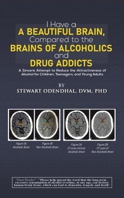 I Have a Beautiful Brain, Compared to the Brains of Alcoholics and Drug Addicts 1