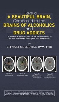 bokomslag I Have a Beautiful Brain, Compared to the Brains of Alcoholics and Drug Addicts