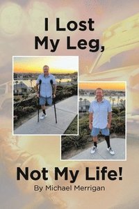 bokomslag I Lost My Leg, Not My Life!