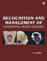 bokomslag Recognition and Management of Congenital Heart Diseases