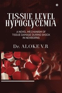 bokomslag Tissue Level Hypoglycemia