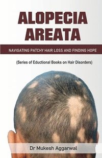 bokomslag Alopecia Areata