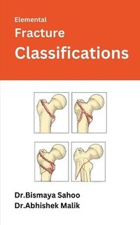 bokomslag Elemental Fracture Classifications