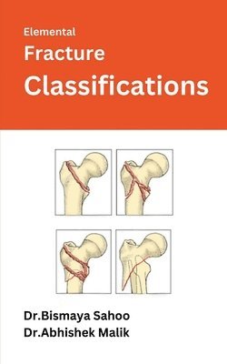 Elemental Fracture Classifications 1