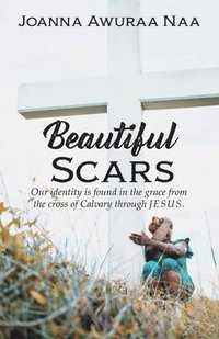 bokomslag Beautiful Scars