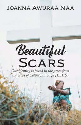 bokomslag Beautiful Scars