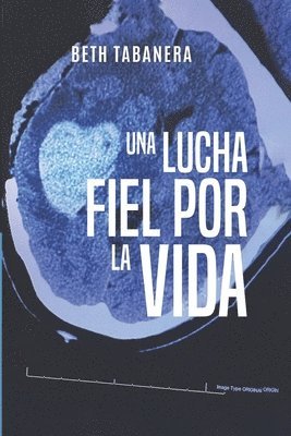 lucha fiel por la vida
