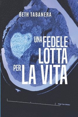 Beth Tabanera - fedele lotta per la vita, Häftad