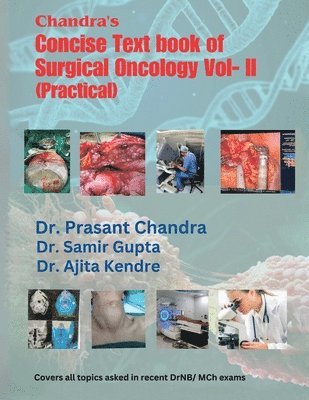 Chandra's Concise Text book of Surgical Oncology Vol- II(Practical) 1