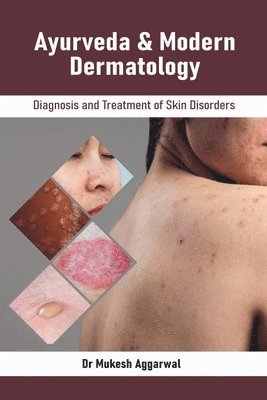 bokomslag Ayurveda & Modern Dermatology