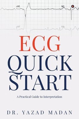 ECG Quick Start 1
