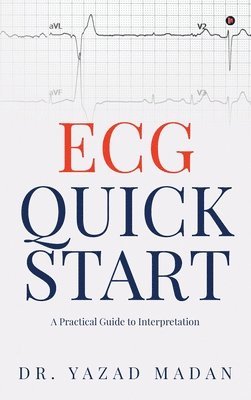 ECG Quick Start 1