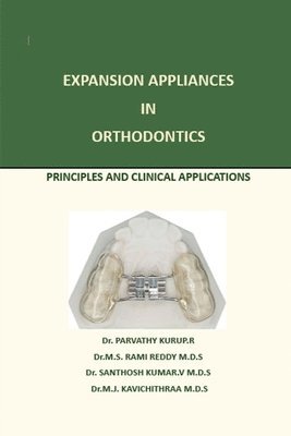 bokomslag Expansion Appliance in Orthodontics