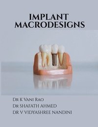 bokomslag Implant Macrodesigns