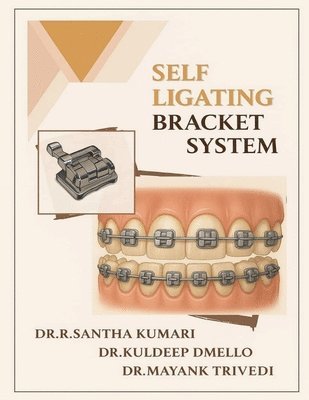 bokomslag Self Ligating Bracket System