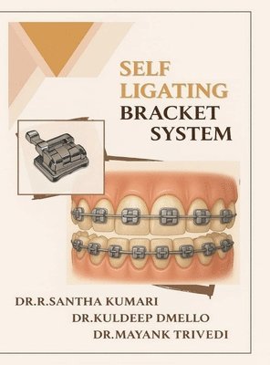 bokomslag Self Ligating Bracket System