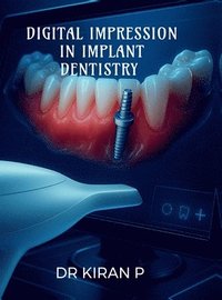 bokomslag Digital Impression in Implant Dentistry