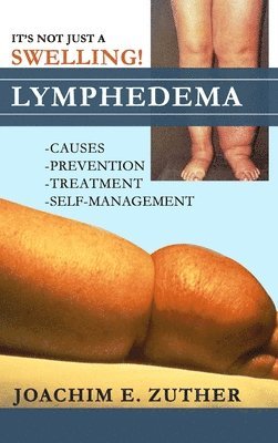 bokomslag It's Not Just a Swelling! Lymphedema