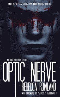 Optic Nerve 1